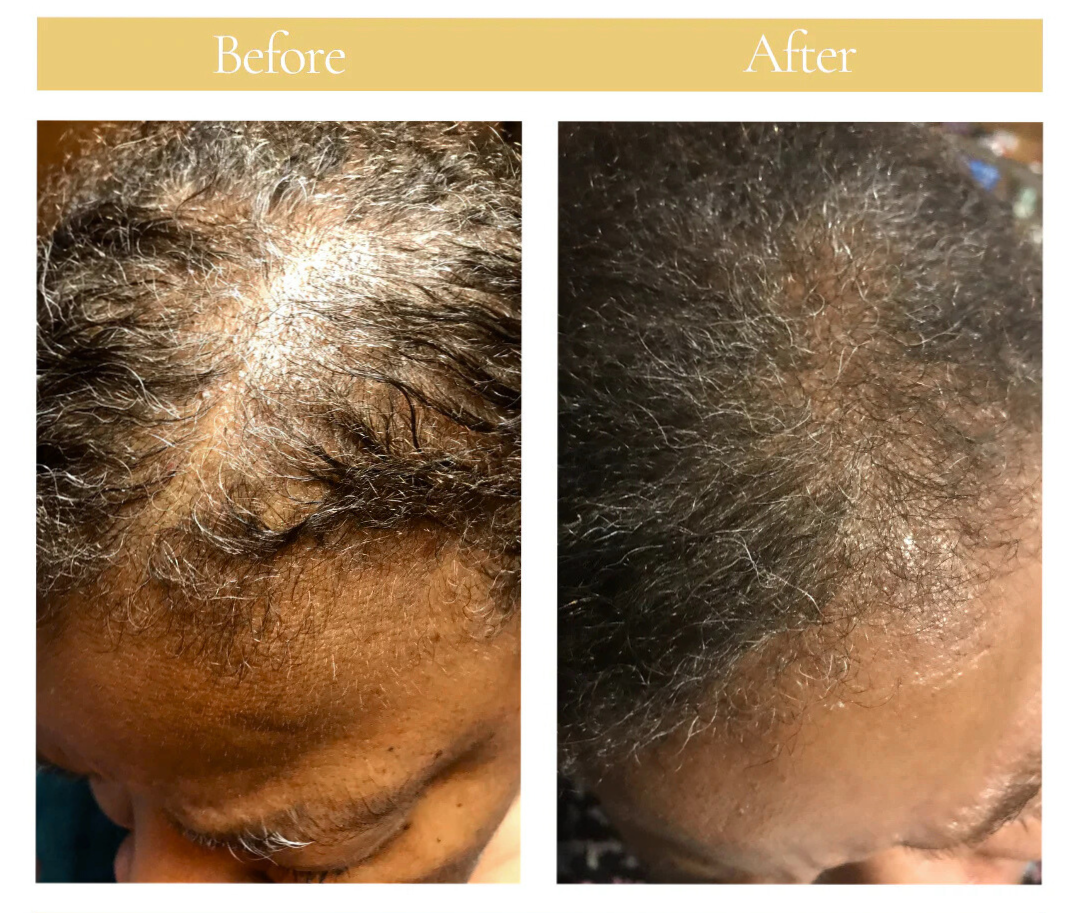 Flourish Natural Hair Oil