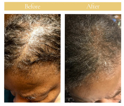 Flourish Natural Hair Oil